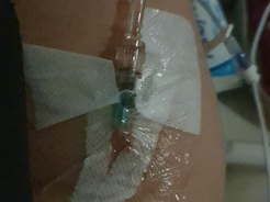 Day 1 on the ward - 17.12.20 - all hooked up to an I.V. - they always struggle to find my veins, this is so painful!
